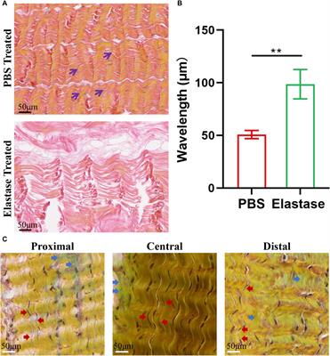 The alteration of the structure and macroscopic mechanical response of porcine patellar tendon by elastase digestion